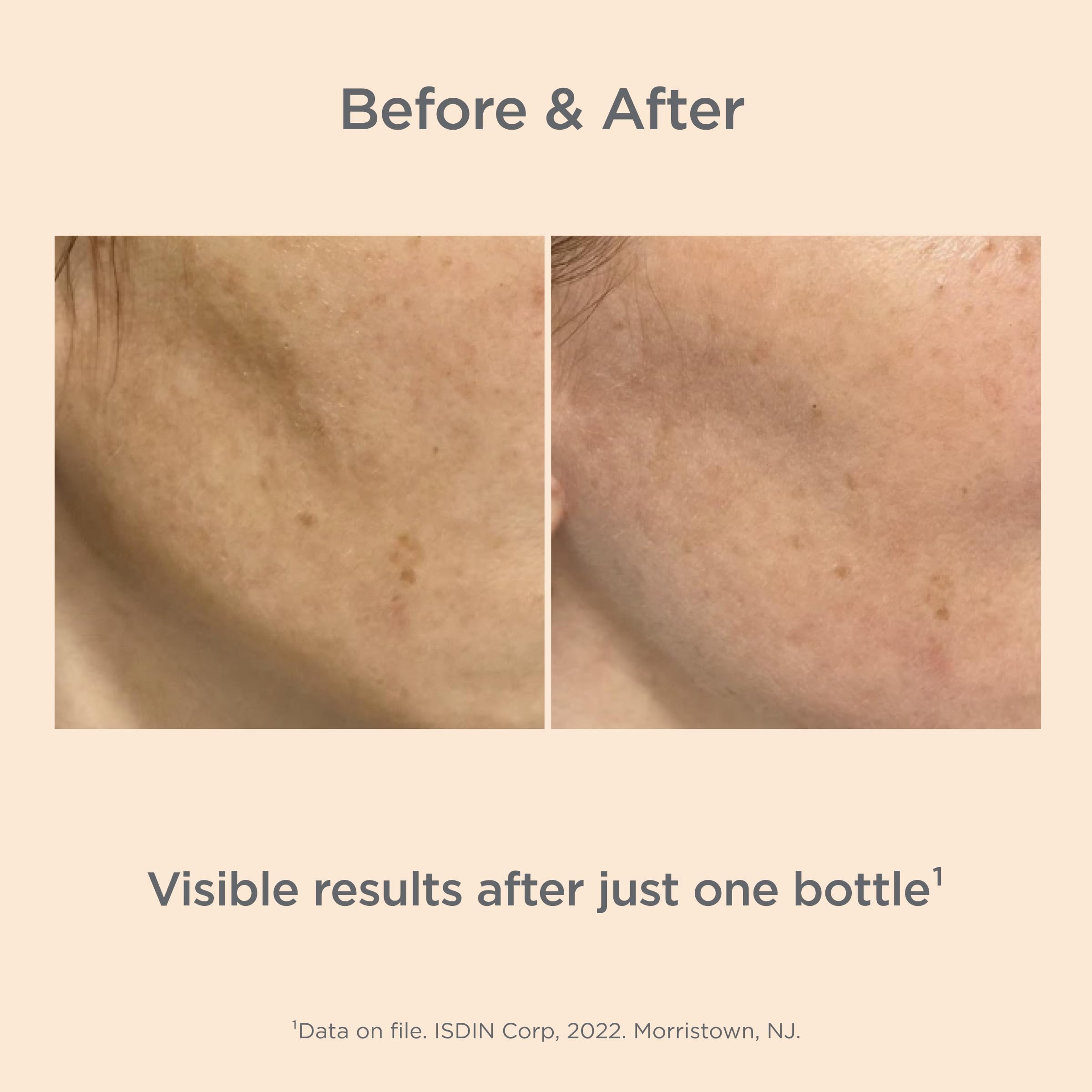 ISDIN Melaclear Advanced night routine visual implies consistent use for results.