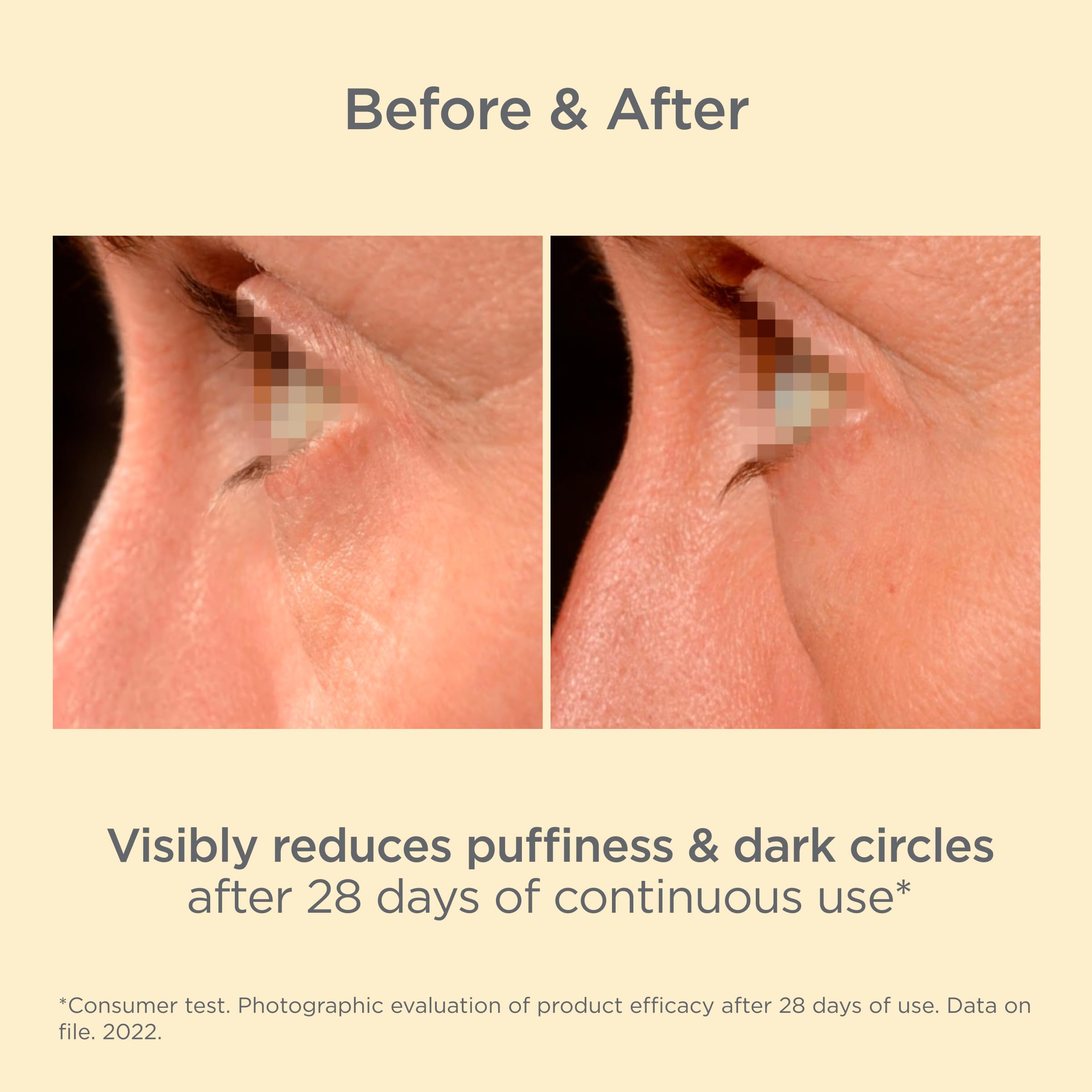 ISDIN Isdinceutics K-Ox Eyes Eyeliss ingredients support elasticity around the eye