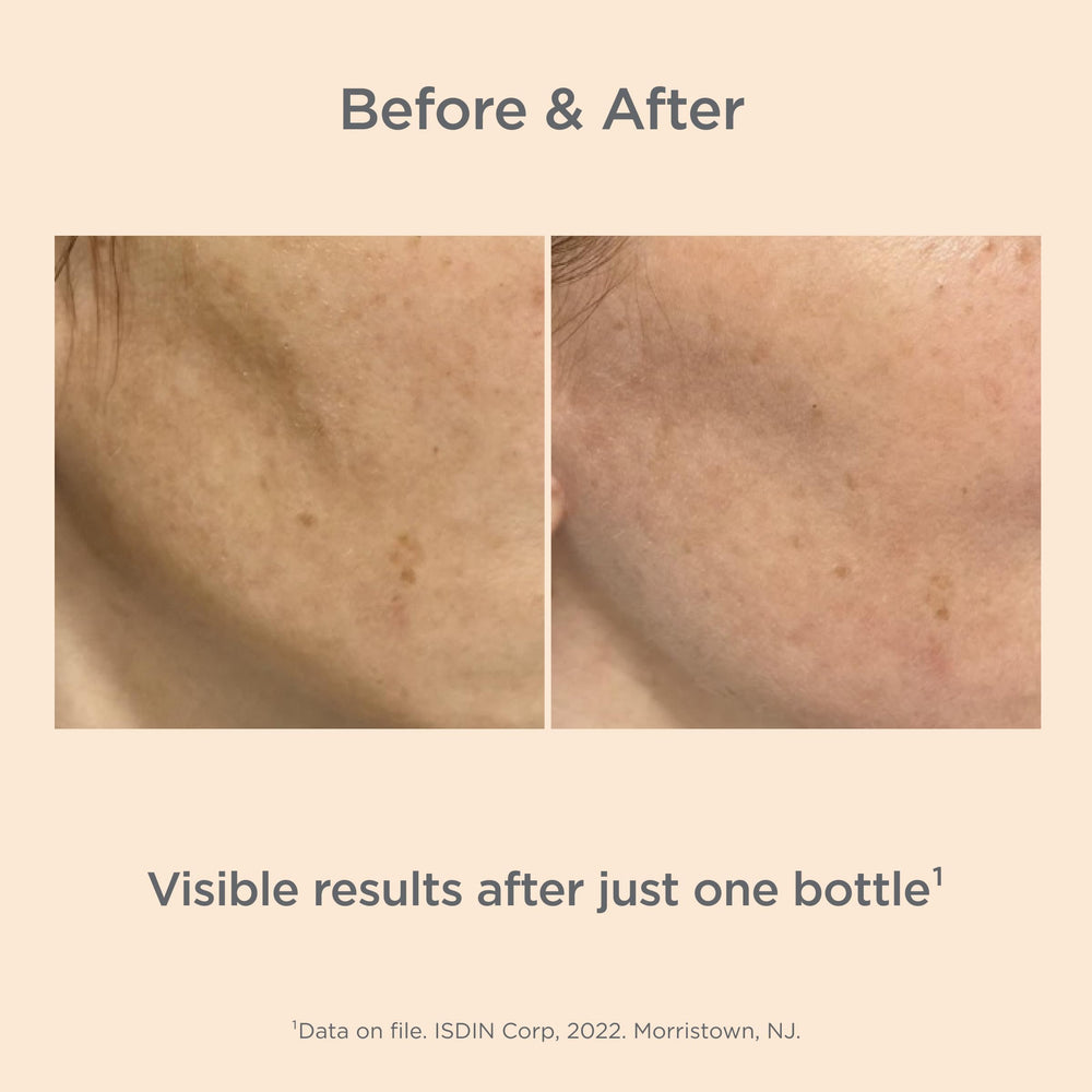 Swatch on skin shows ISDIN Melaclear Advanced potential for even skin tone.