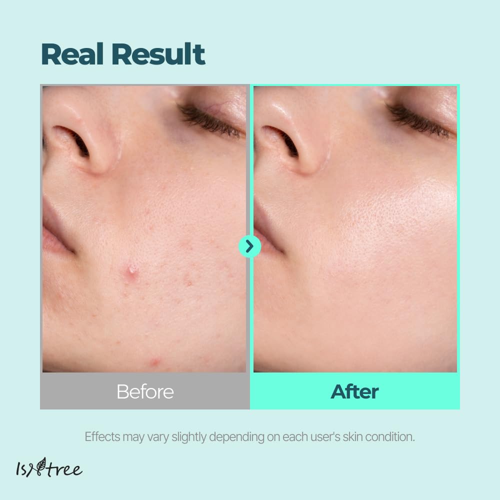IsNtree Gim PDRN Water-Balm Texture highlights lightweight, non-sticky moisture delivery.