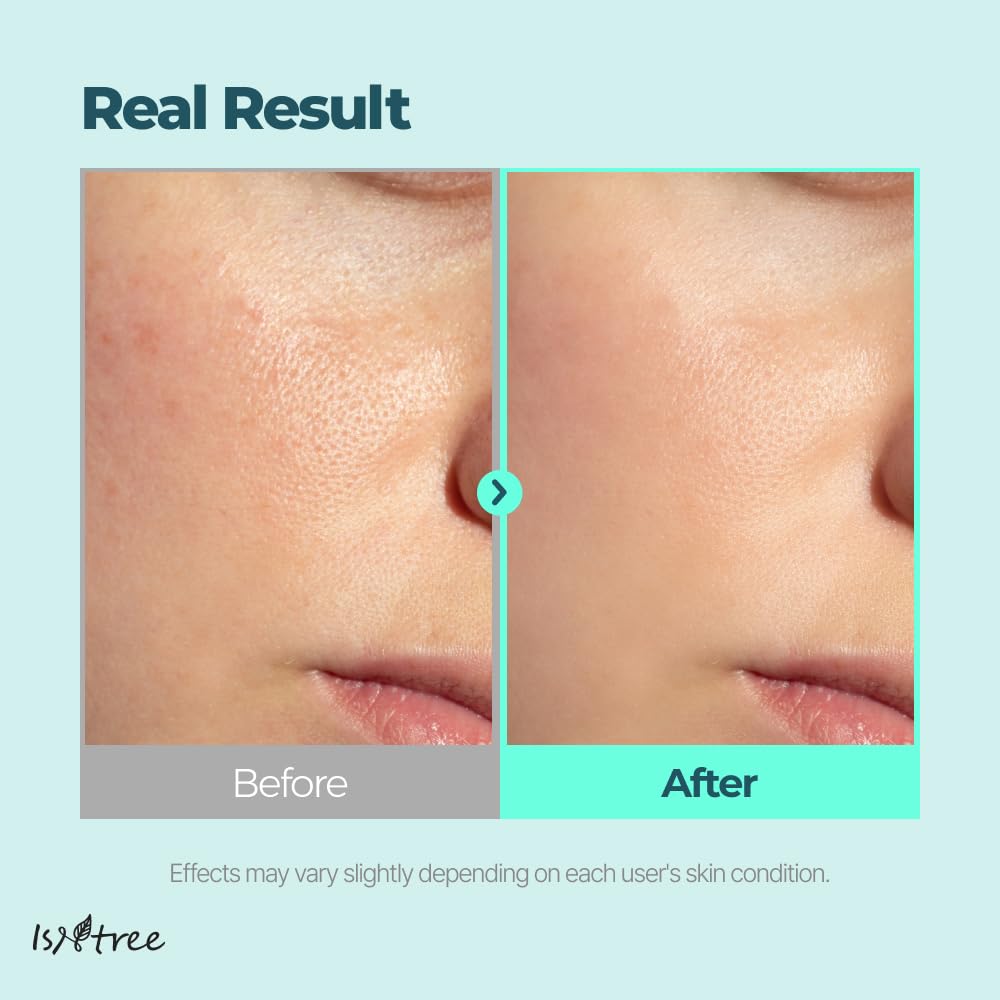 IsNtree Gim PDRN Hydro Ampoule pump-action close-up emphasizes easy, mess-free application.