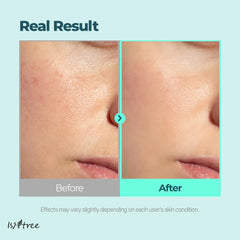 IsNtree Gim PDRN Hydro Ampoule pump-action close-up emphasizes easy, mess-free application.