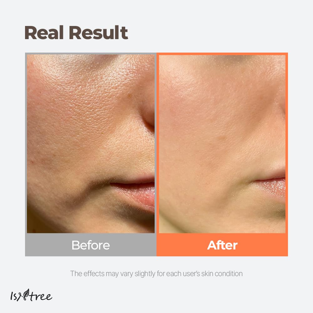 ISNTREE green tea fresh toner on cotton pad for gentle application.