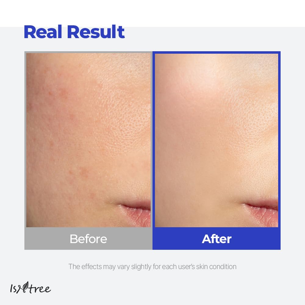 IsNtree Hyaluronic Acid Aqua Gel Cream matte finish on skin suggesting balanced moisture