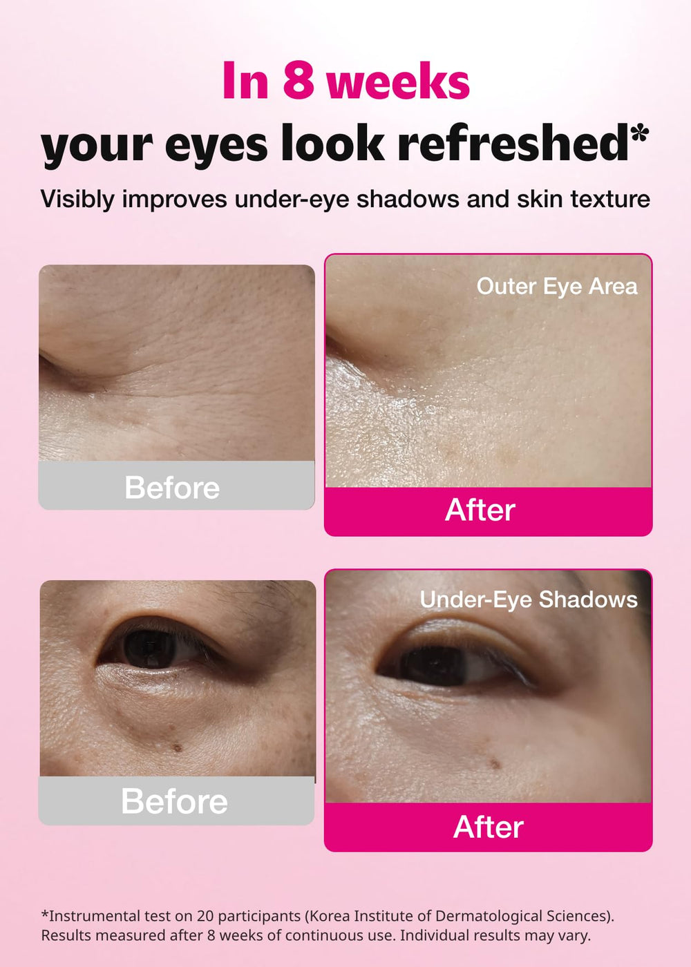 ISOI Blemish Care Under Eye Patch application shows cooling relief for puffiness and dark circles.