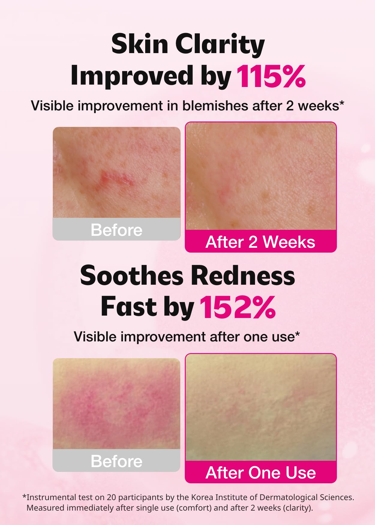 Close-up of ISOI Blemish Care Up Serum texture on skin showing smooth finish