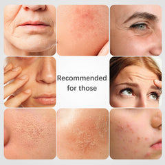 ISTON bio-collagen mask close-up highlights elasticity boost and firmer-looking skin.