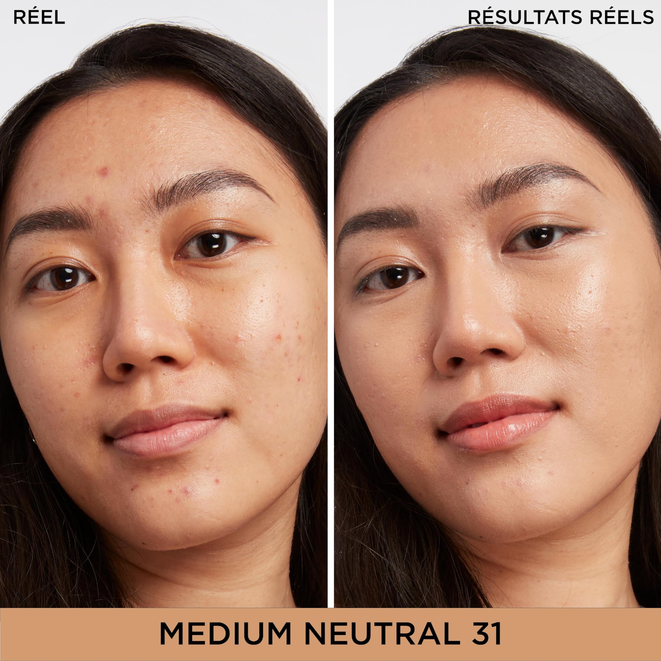 IT Cosmetics Bye Bye Dark Spots Concealer dual-applicator demonstrates precise spot targeting and blending
