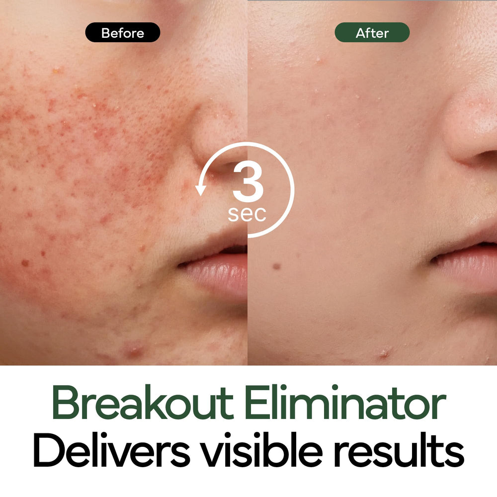 IVOSKIN Intensive Cica Repair Cream ceramides Hyaluronic Acid matrix illustration.