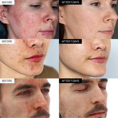 IVOSKIN Intensive Cica Repair Cream Madecassoside close-up shows soothing complex.