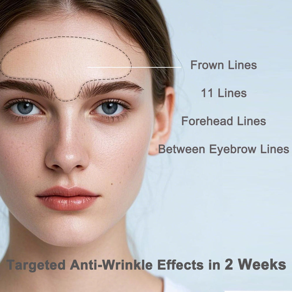 IyxicmI patch focusing on glabellar lines provides extended coverage for frown lines