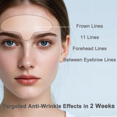 IyxicmI patch focusing on glabellar lines provides extended coverage for frown lines