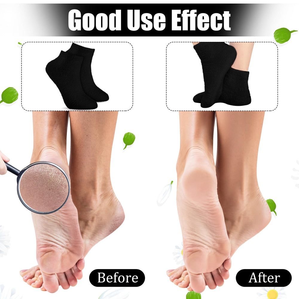 Janmercy Aloe Socks machine washable for daily use