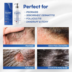 Jardient psoriasis shampoo herbal ingredients magnified for natural care.