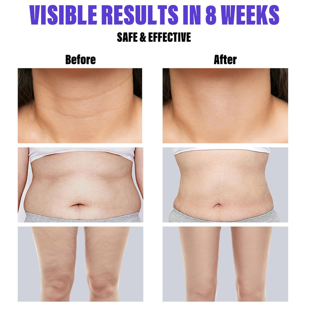 Jnshu Xufed tightening cream promotes stretch-mark reduction and firmer, more sculpted contours.