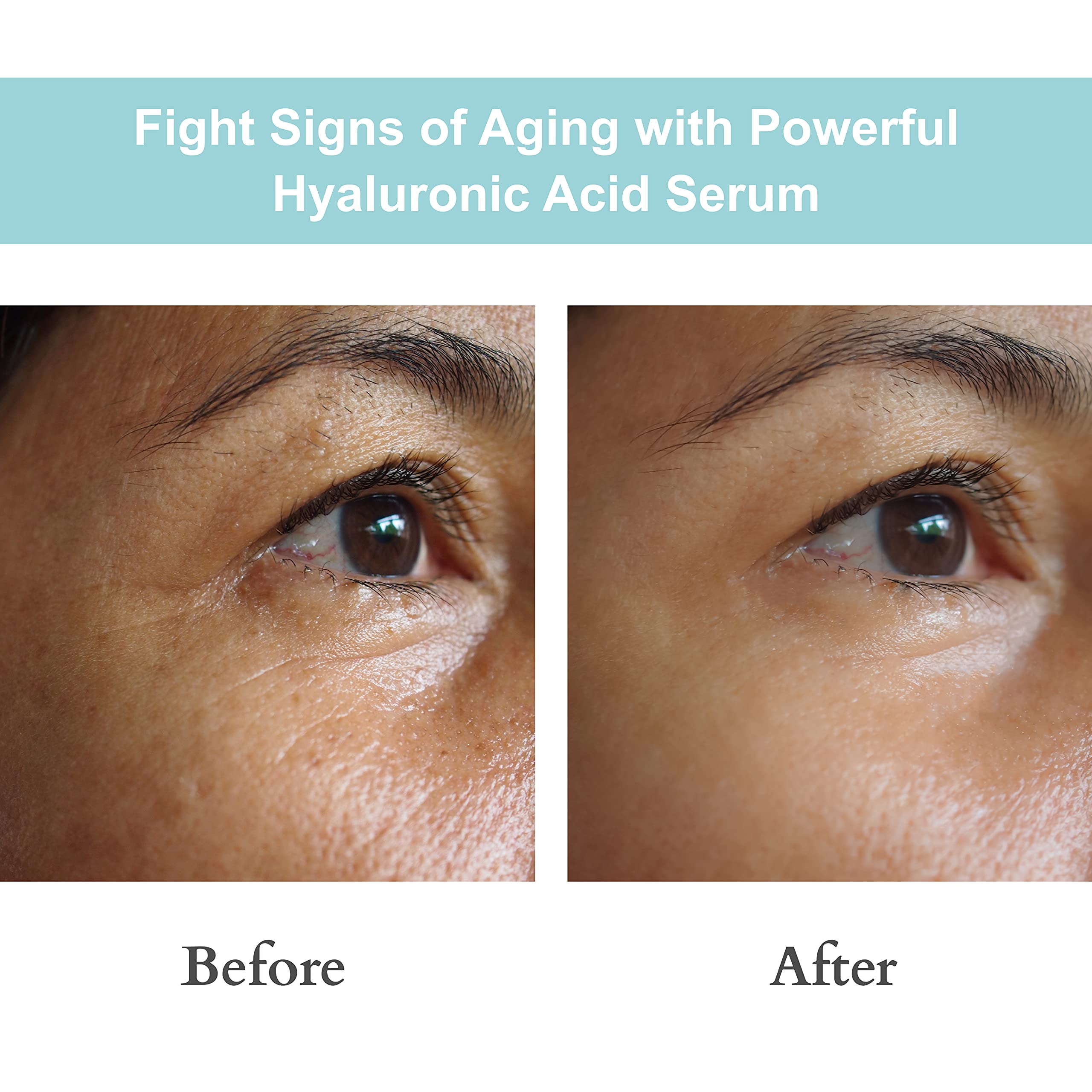 JOYAL BEAUTY serum applied to cheek for hydrated, refreshed appearance.