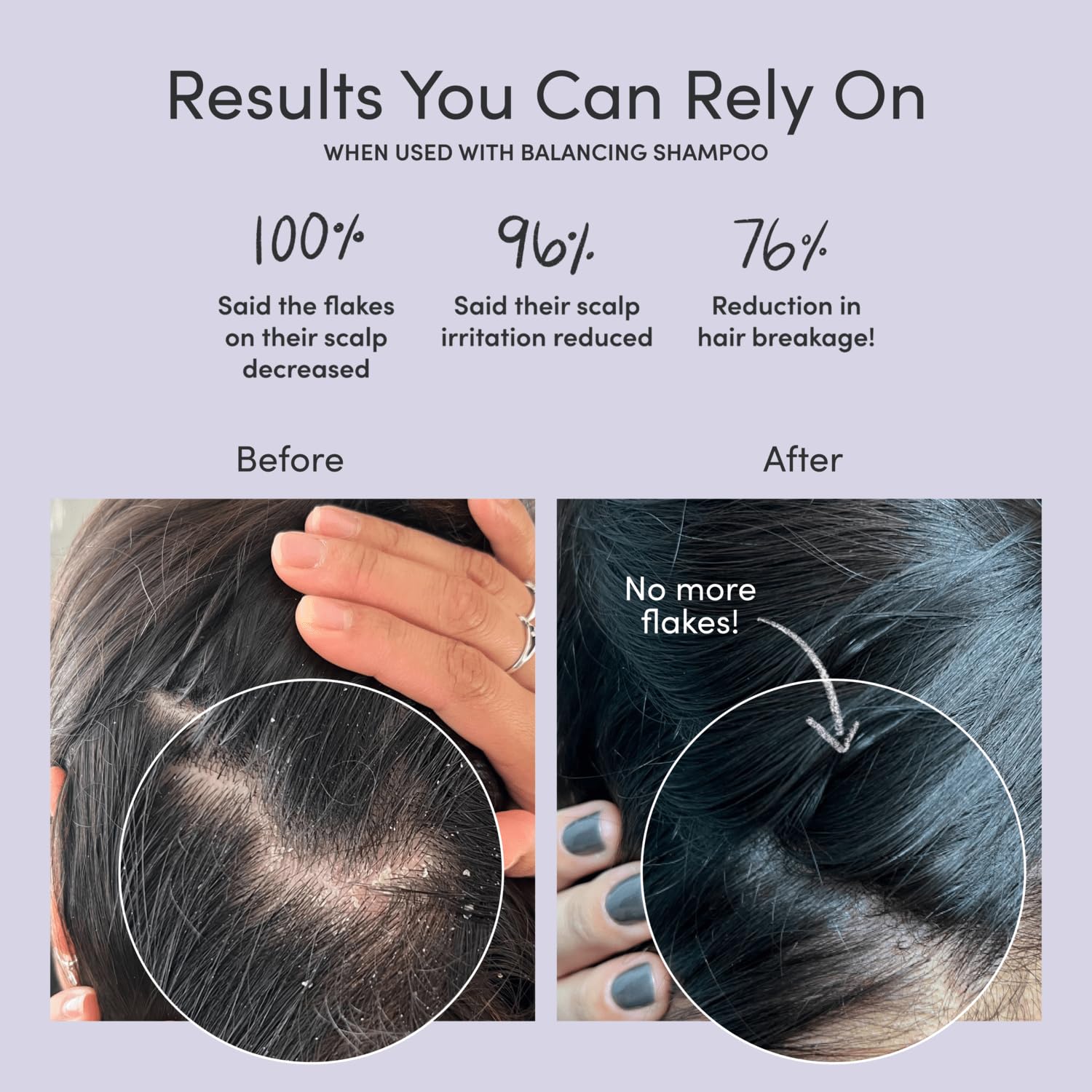 Jupiter Restoring Scalp Serum application dot demonstrates easy, precise leave-on use.