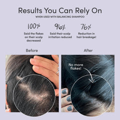Jupiter Restoring Scalp Serum application dot demonstrates easy, precise leave-on use.