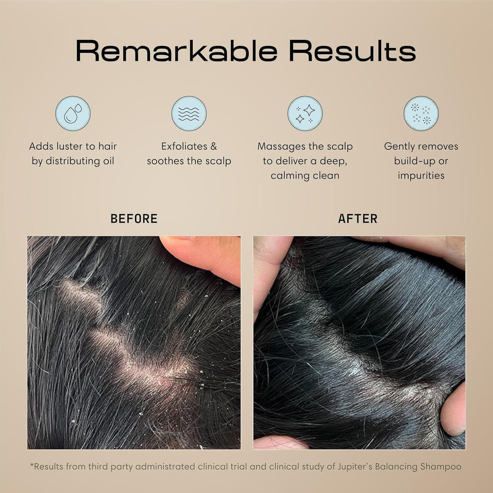 Jupiter scalp exfoliator bristle close-up with flexible tips that gently lift flakes and residue