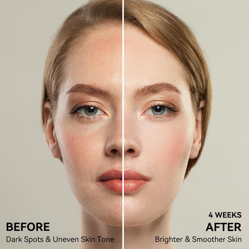 JURVEW dark spot remover serum featuring its 360-degree roller applicator.