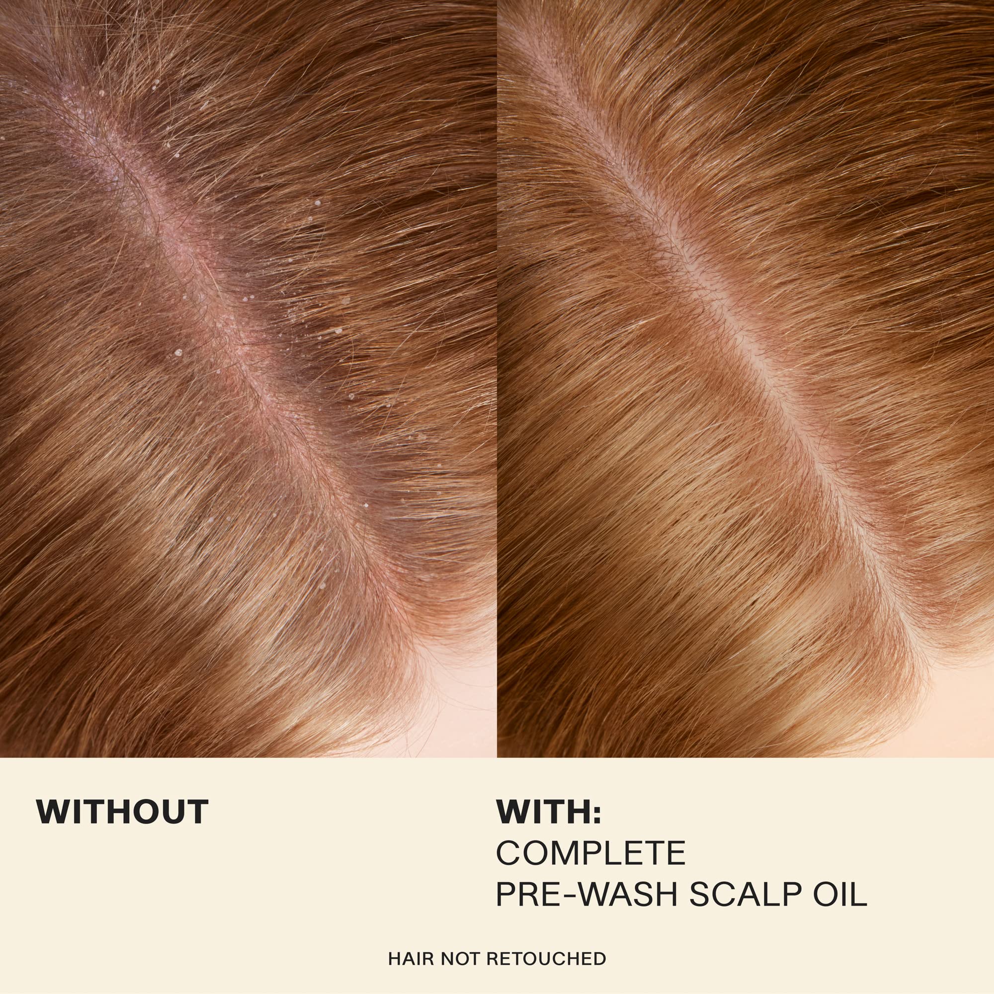 Rosemary extract visual highlights improved scalp circulation for healthier roots