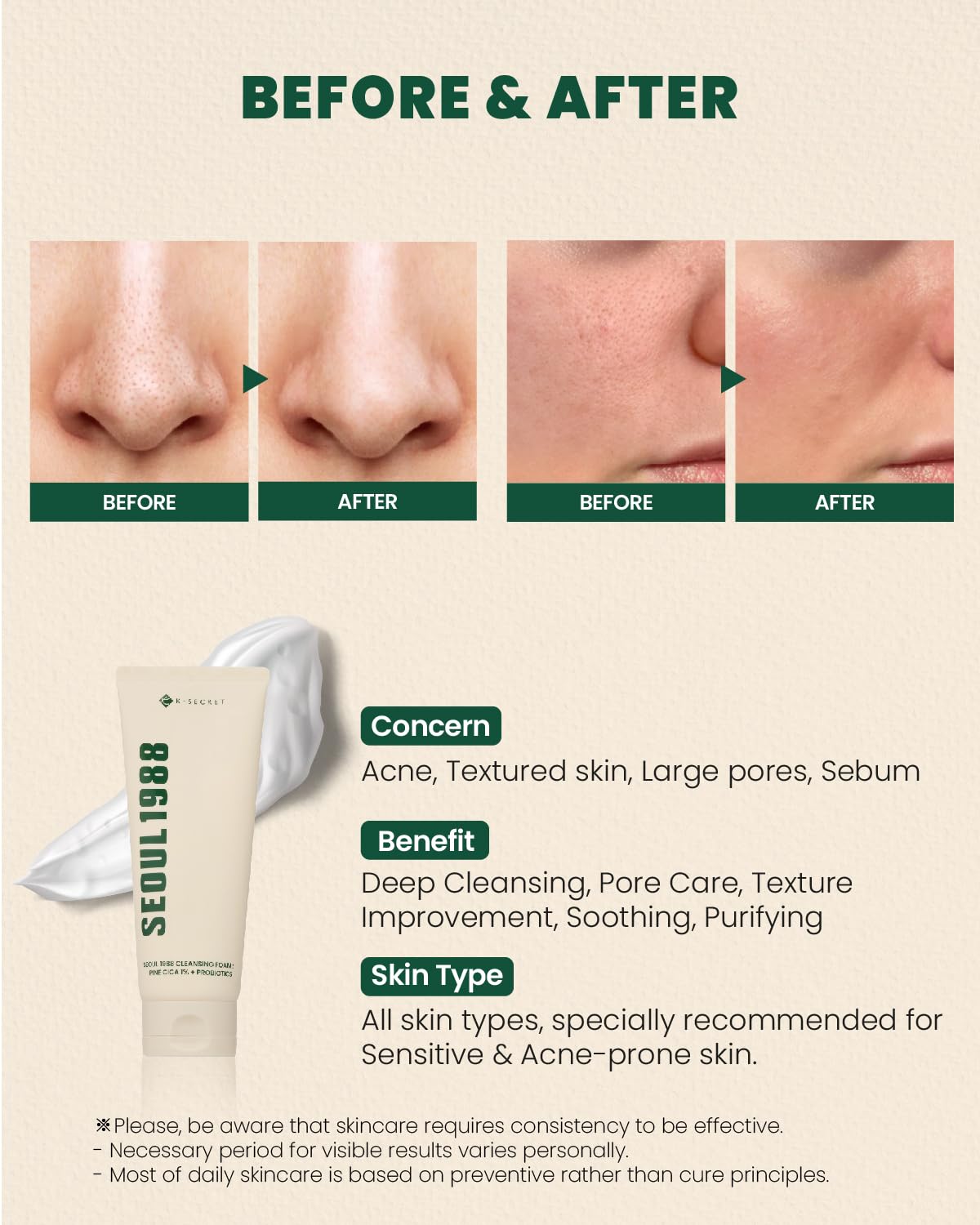 K-SECRET Seoul 1988 Cica Cleansing Foam Centella Asiatica soothing irritated skin