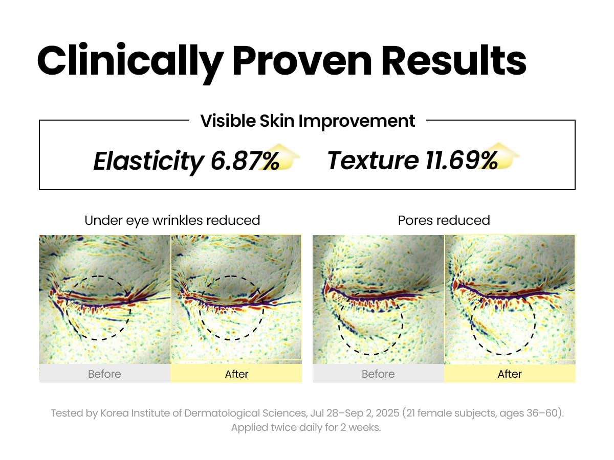 K-SECRET Seoul 1988 Retinal Serum texture swirl demonstrates easy spread