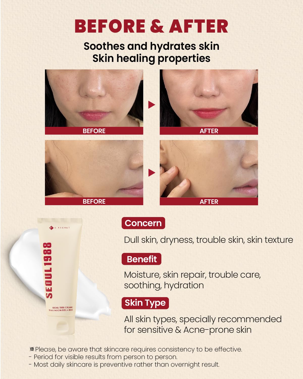 K-SECRET Seoul 1988 Snail Mucin 93% Cream application swatch for skincare routine