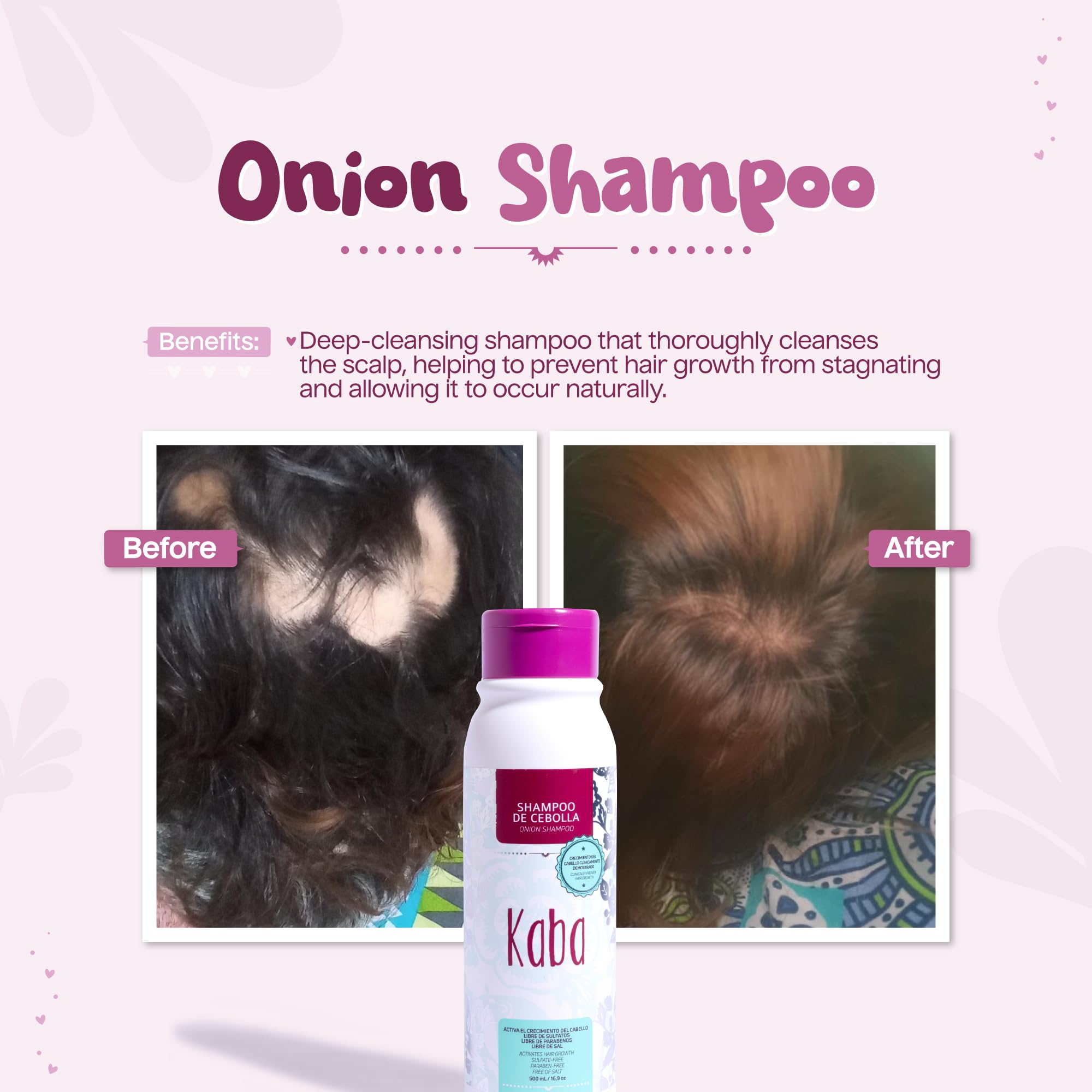 Kaba Onion Shampoo lather demonstrates deep cleansing for hair health.