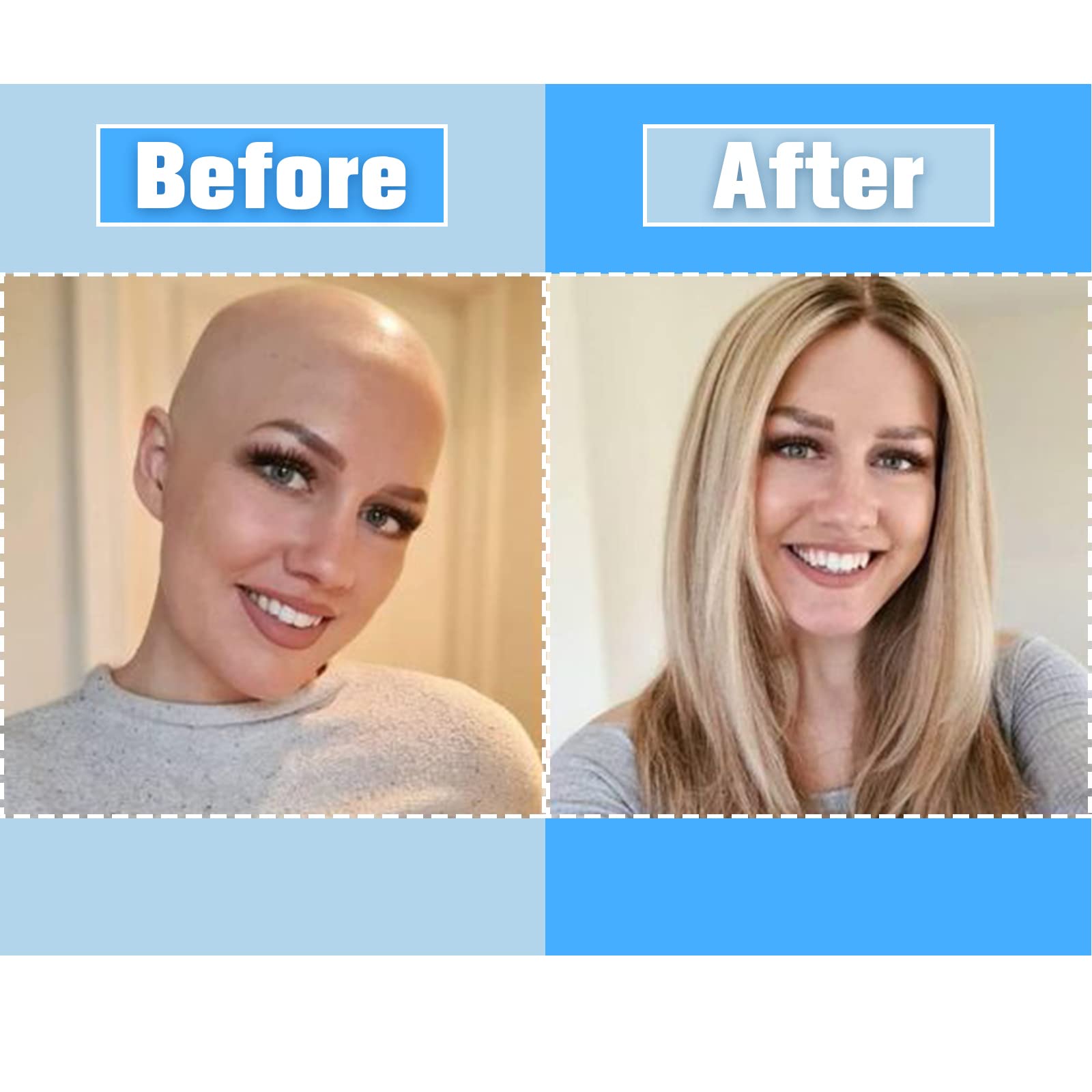 Kachanaa hair extension remover tool enables gentle, residue-free removal.