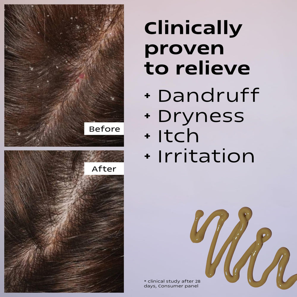 KAMEDIS scalp moisturizer lotion shows greenish-brown color signaling botanical formula.