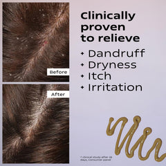 KAMEDIS scalp moisturizer lotion shows greenish-brown color signaling botanical formula.