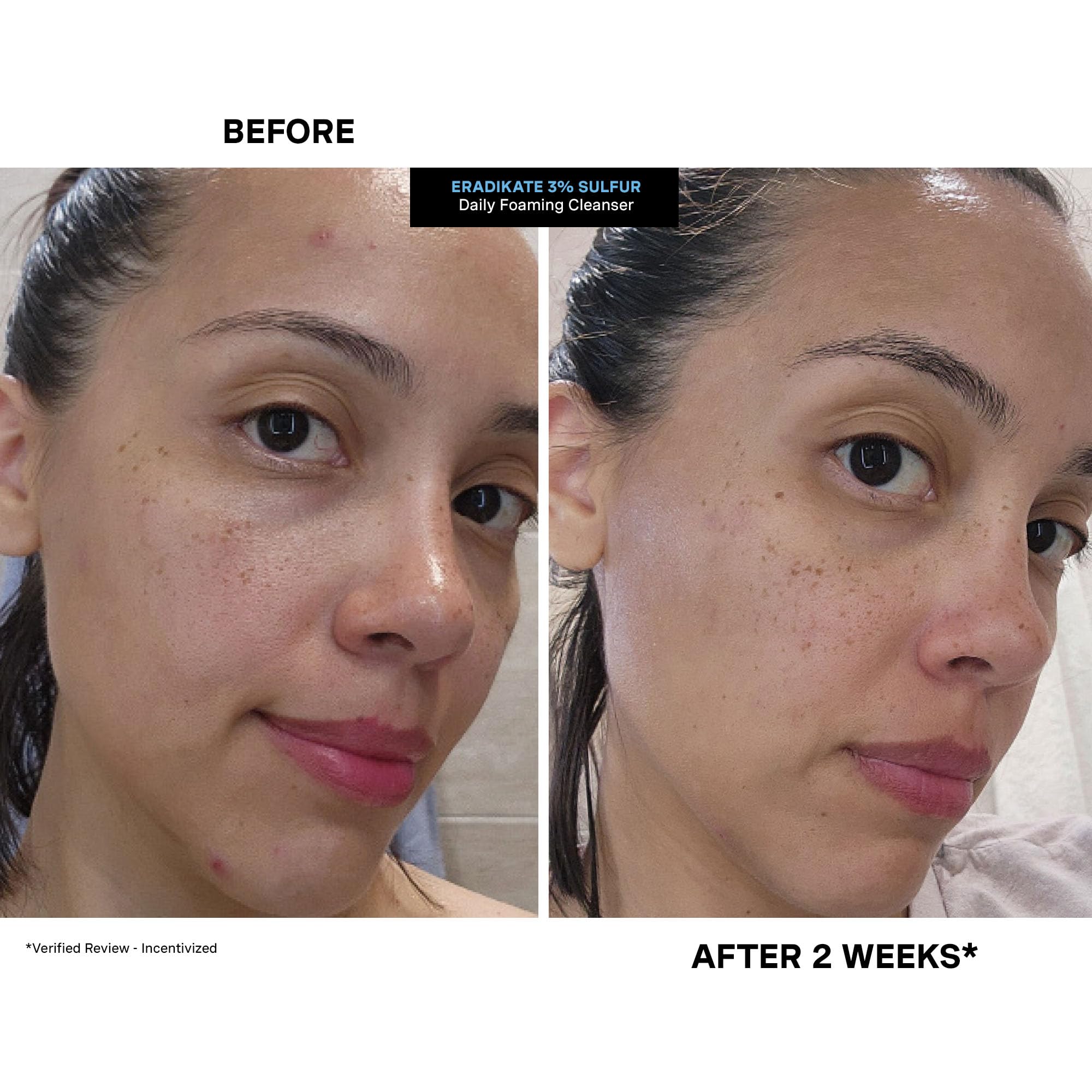 Pores appear refined after cleansing, suggesting a fresh start to your routine