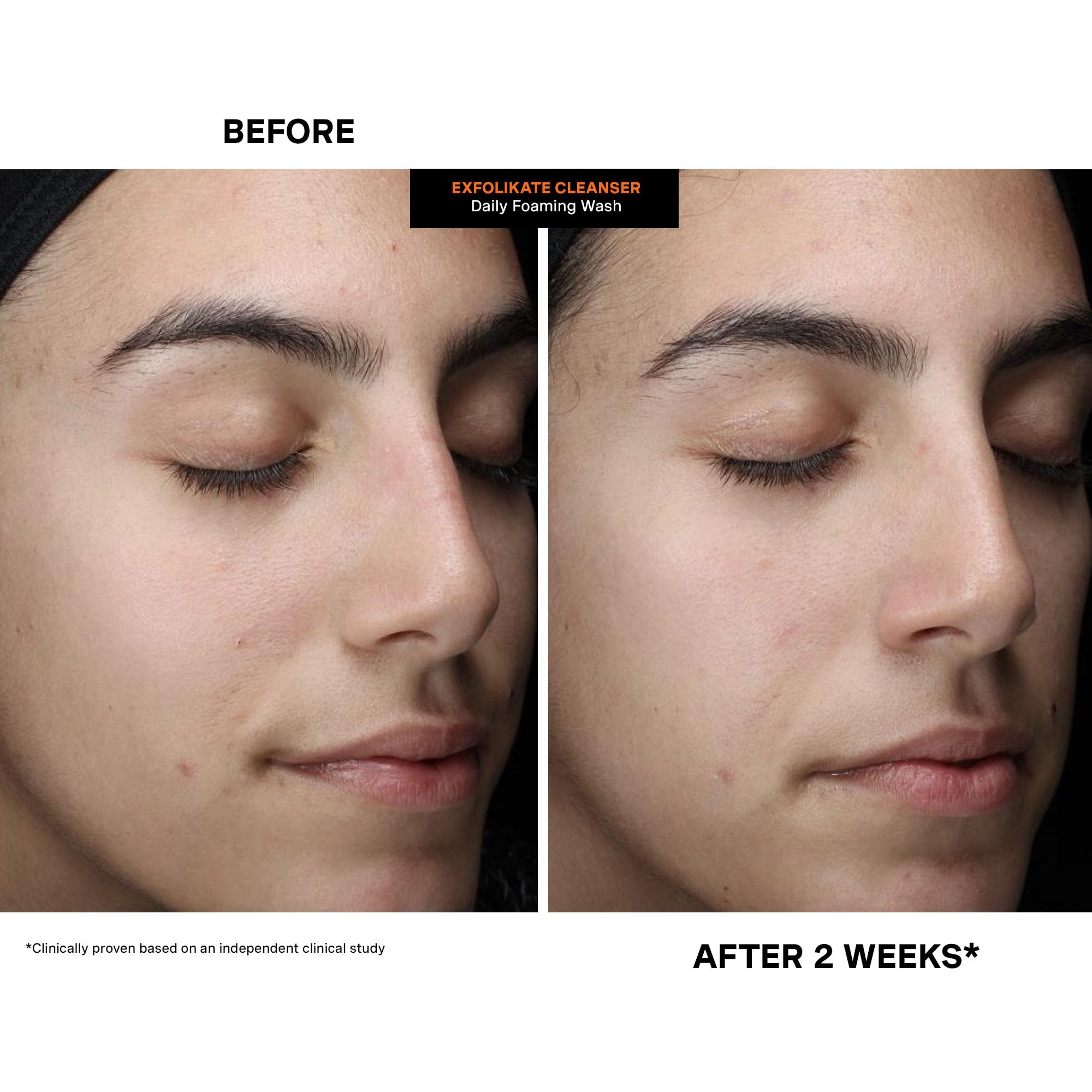 Kate Somerville ExfoliKate Cleanser clinic-tested results emphasis