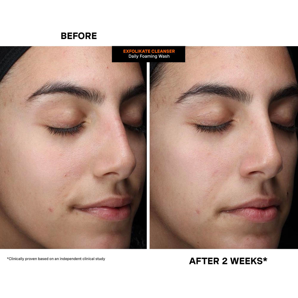 Kate Somerville ExfoliKate Cleanser clinic-tested results emphasis