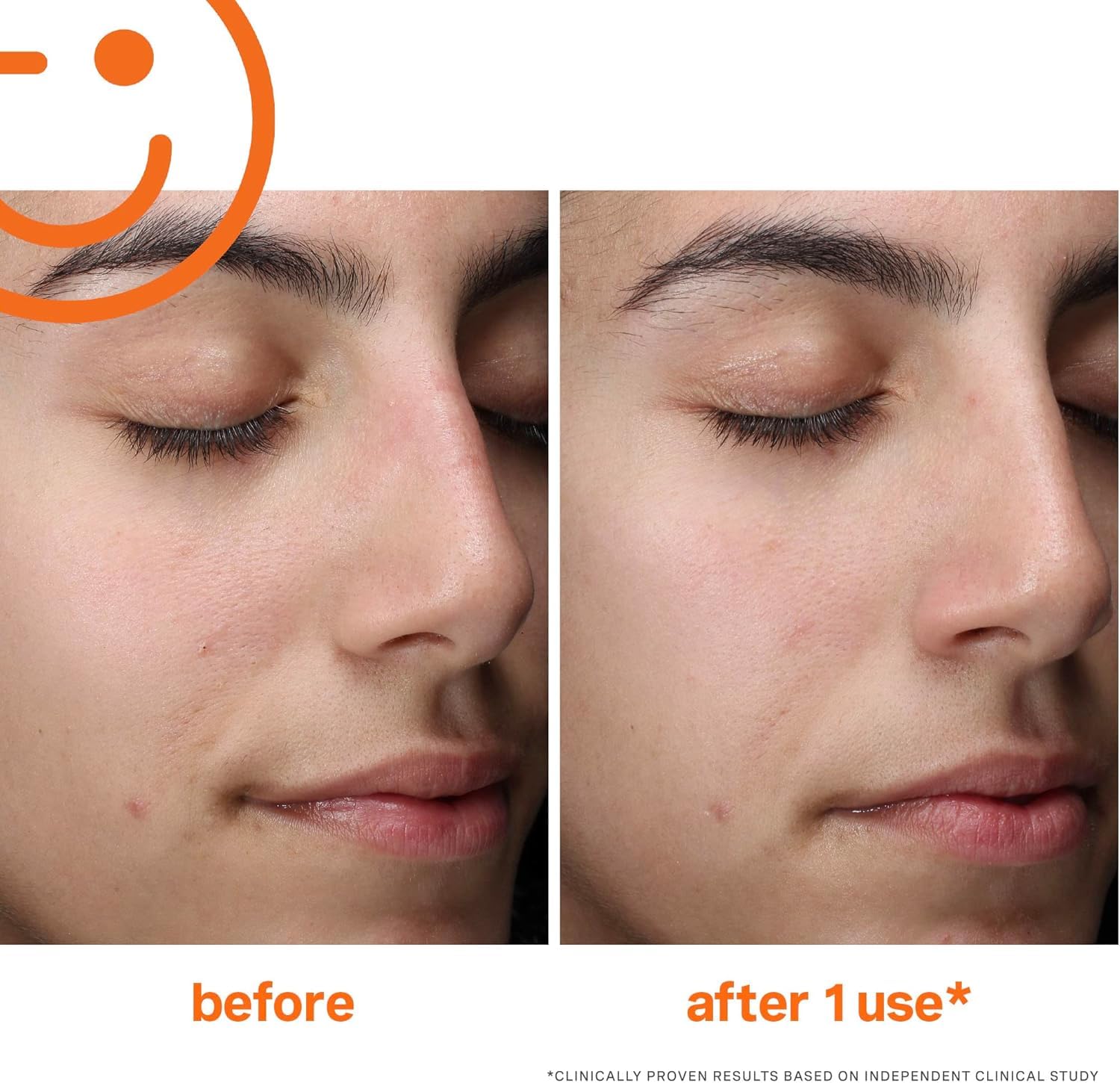 Enzyme blend on Kate Somerville Exfolikate Cleanser label for smoother texture.