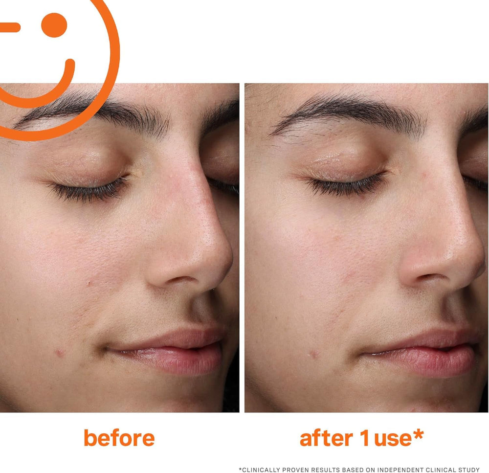 Enzyme blend on Kate Somerville Exfolikate Cleanser label for smoother texture.