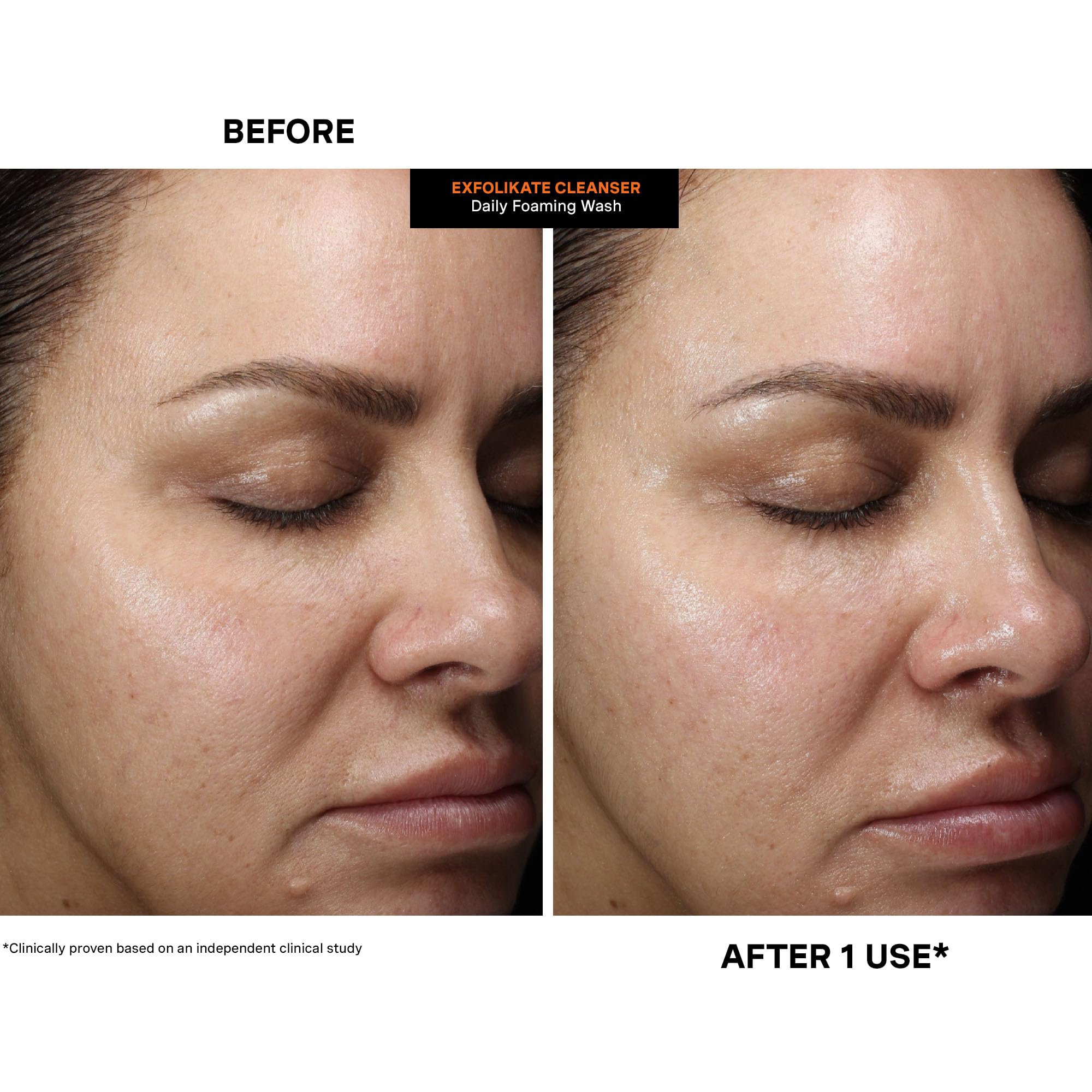 Kate Somerville ExfoliKate Cleanser no harsh ingredients like SLS or parabens