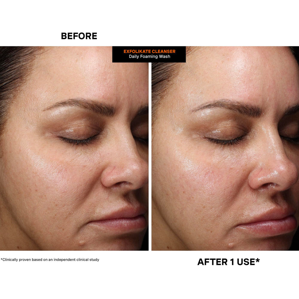 Kate Somerville ExfoliKate Cleanser no harsh ingredients like SLS or parabens