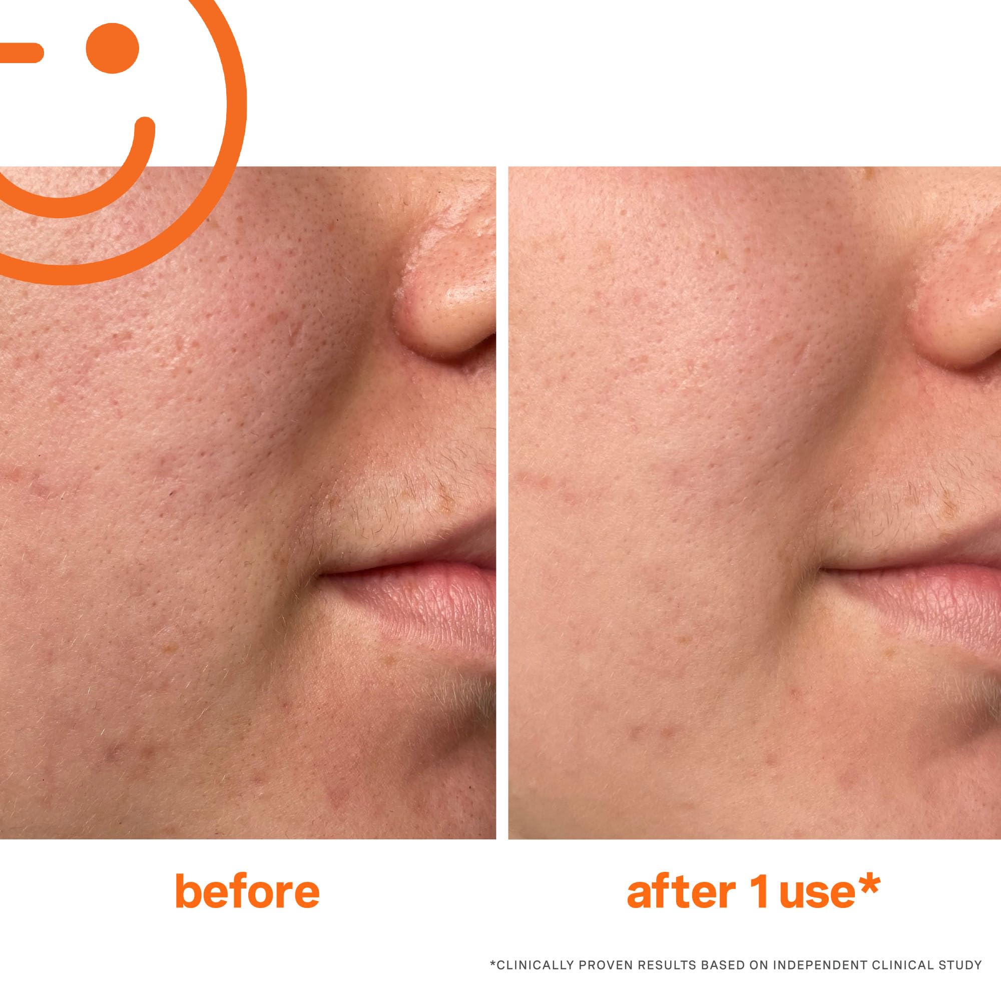 Kate Somerville Exfolikate jar open ready for weekly glow boost.