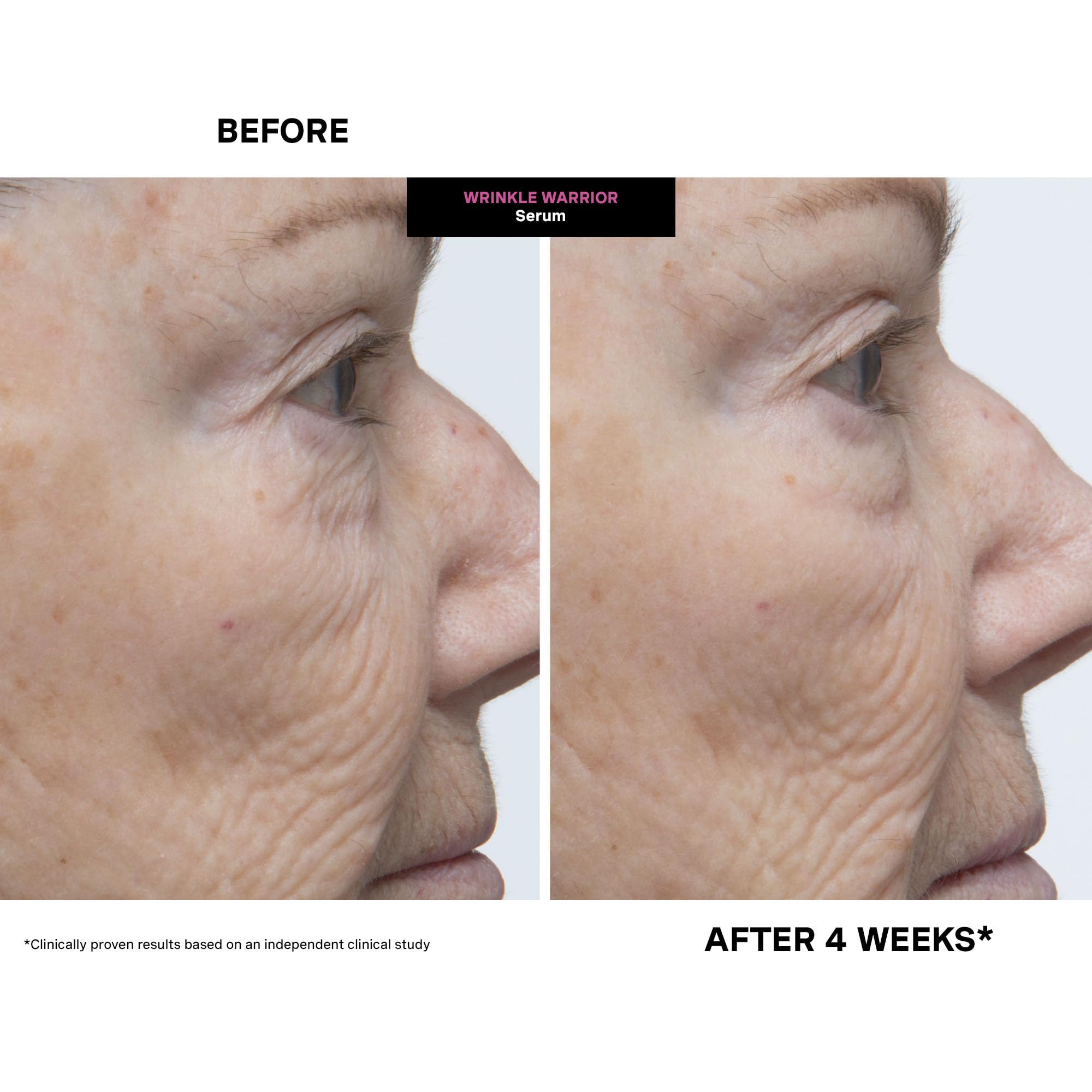 Kate Somerville Wrinkle Warrior texture closeup reveals plumping effect on skin.