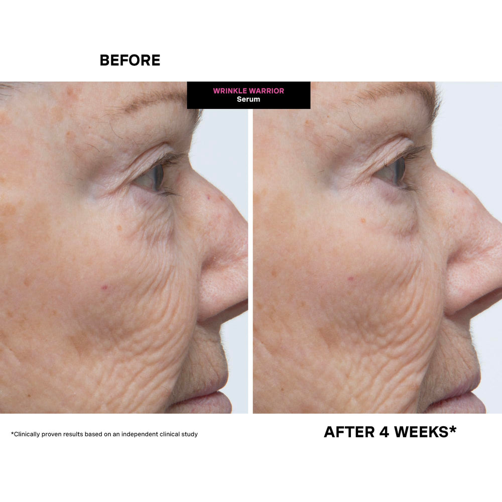 Kate Somerville Wrinkle Warrior texture closeup reveals plumping effect on skin.