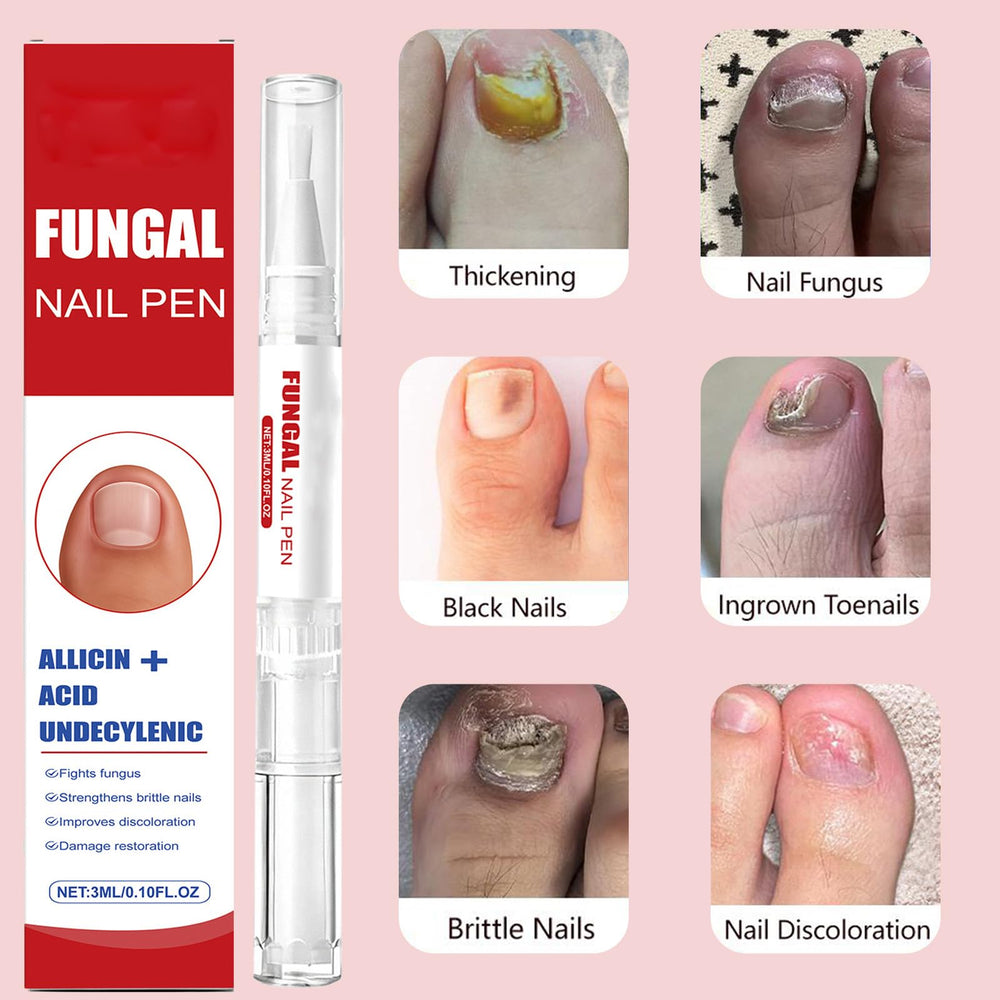 KBSBUBB fungal nail pen on dresser for easy, on-the-go care