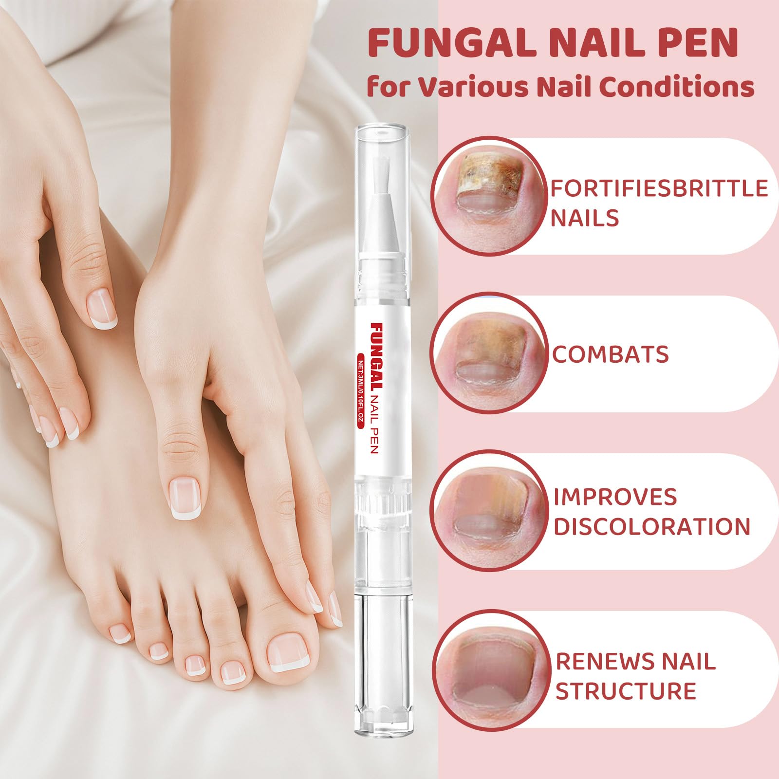 KBSBUBB fungal nail pen precision tip enables precise application near cuticles