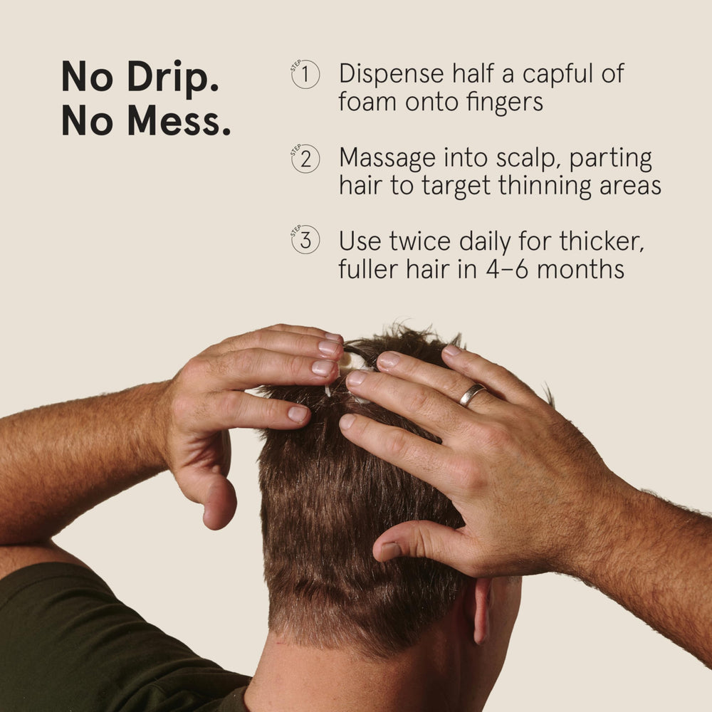 Keeps 5% minoxidil-foam use-on-scalp image emphasizes quick, mess-free coverage.