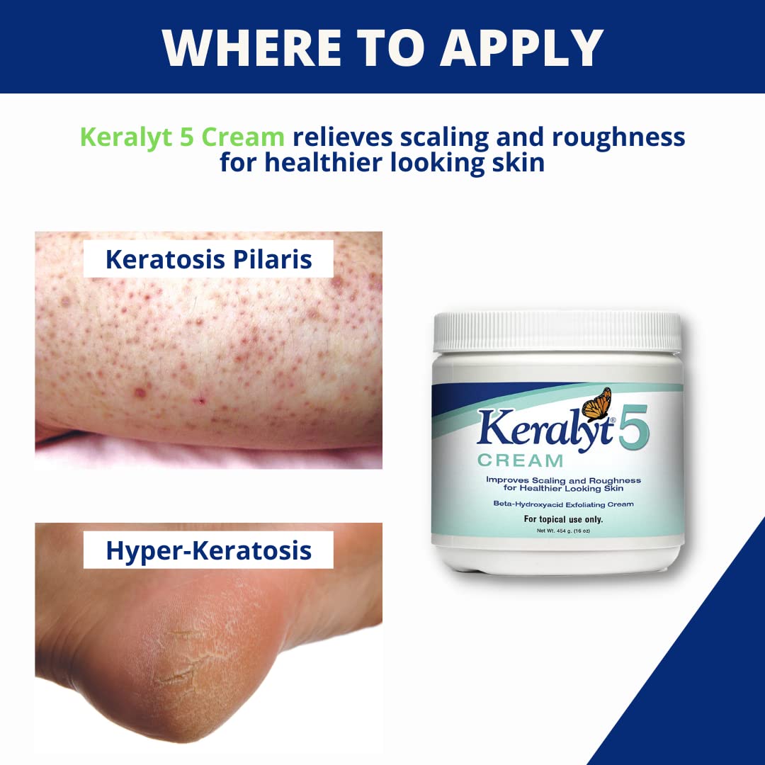 After bathing, seal moisture with Keralyt 5% cream