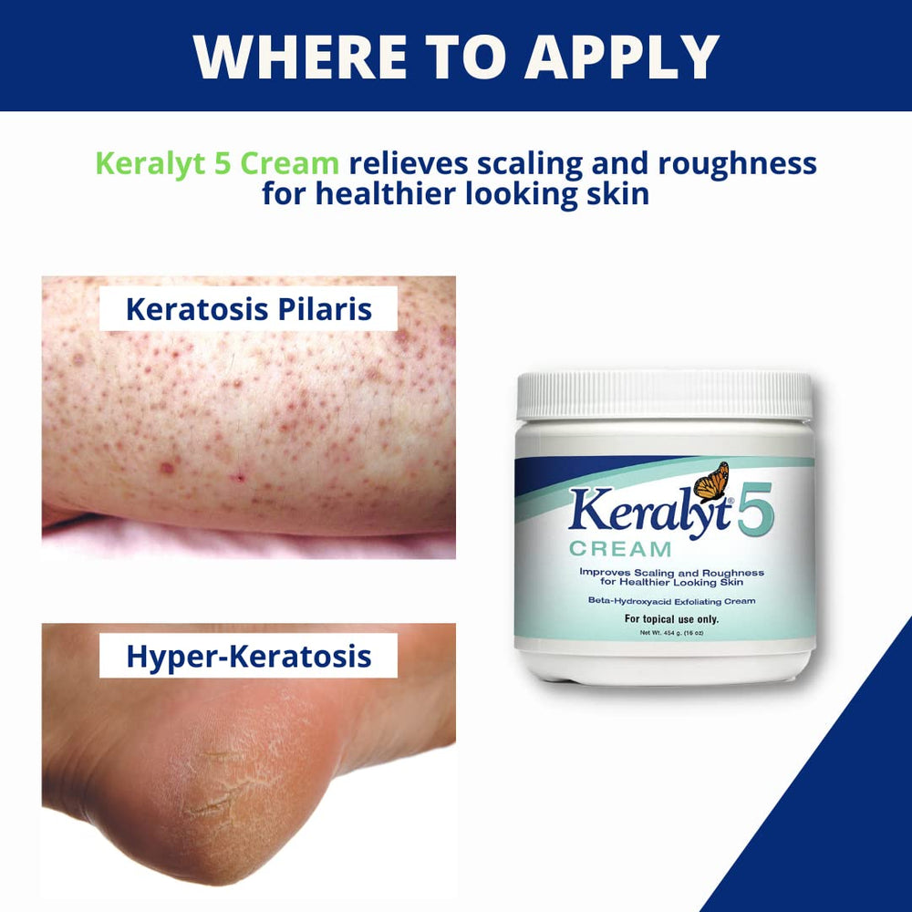 After bathing, seal moisture with Keralyt 5% cream