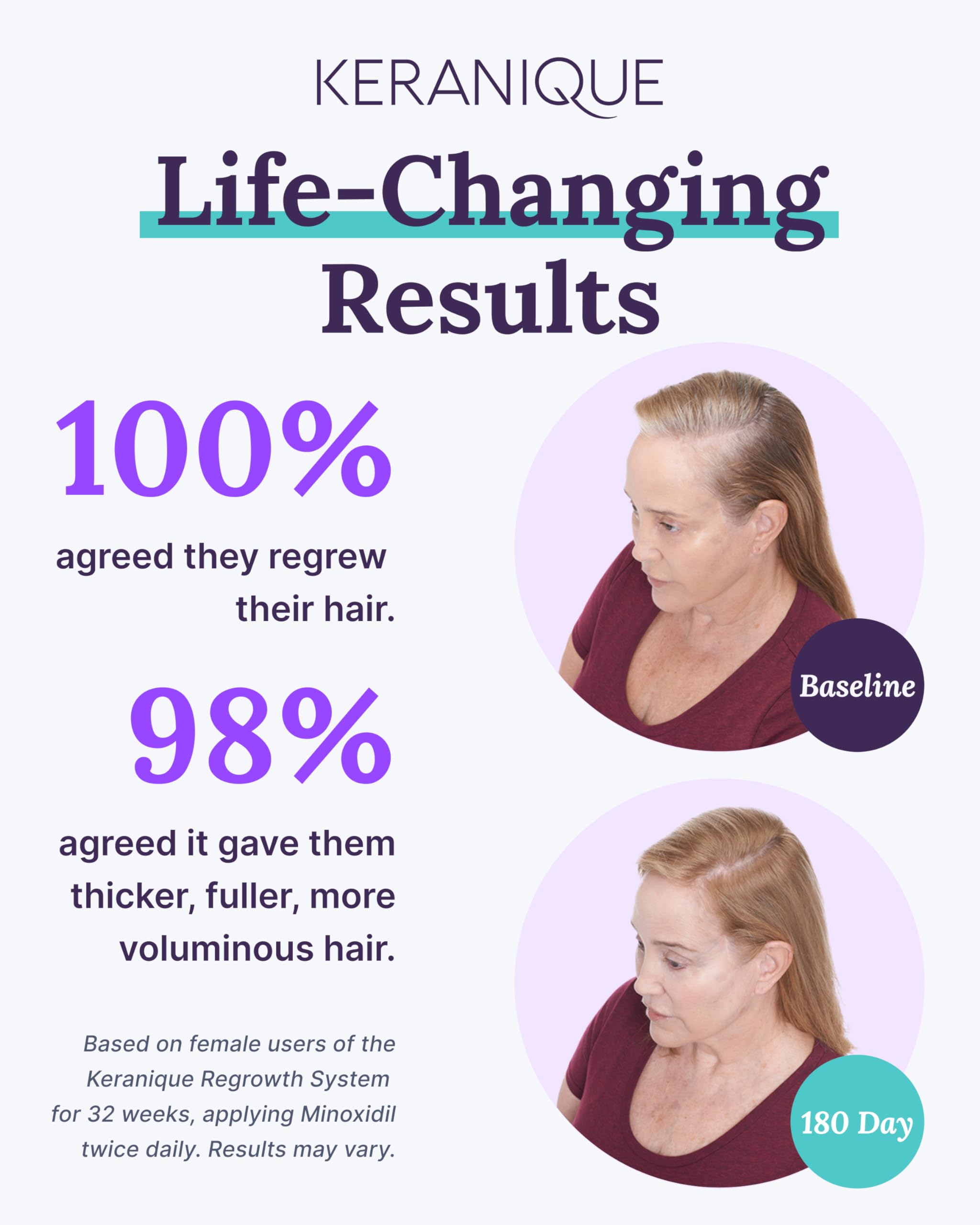 Keranique minoxidil solution bottle closeup suggests regrowth support for women with thinning areas.
