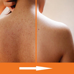 KERAPIL Exfoliating Body Wash ceramides label highlights skin barrier support.