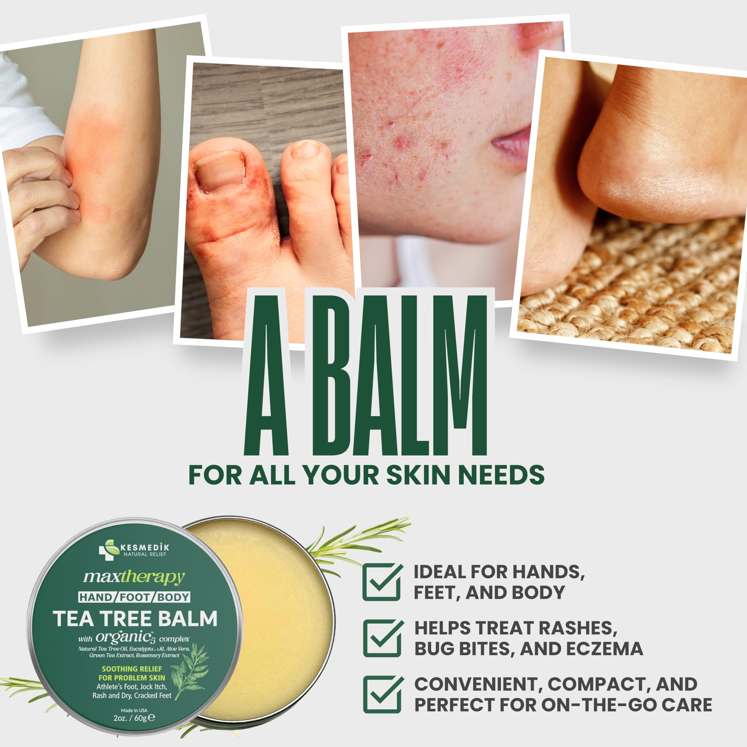 KESMEDIK Tea Tree Oil MaxTherapy Balm ingredients include aloe vera and beeswax.
